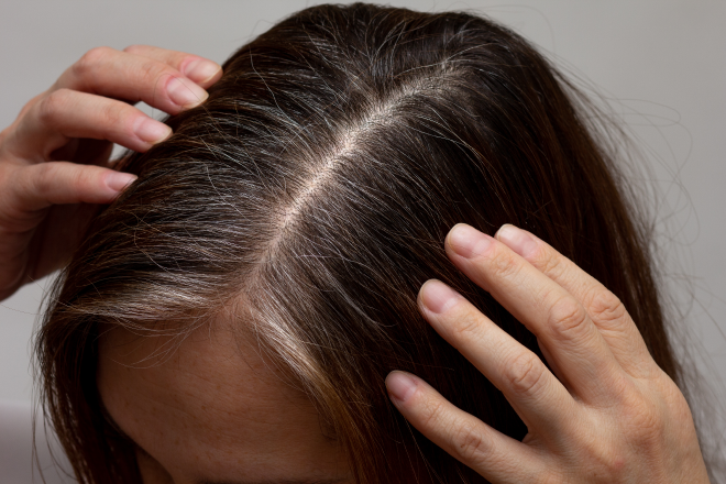 Quelle coloration pour les premiers cheveux blancs ?